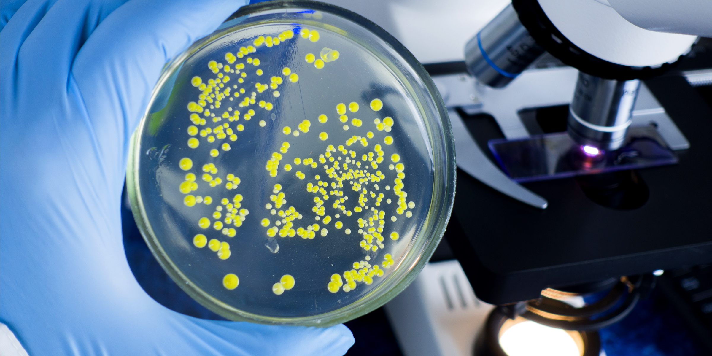 Bacteria | Source: Shutterstock